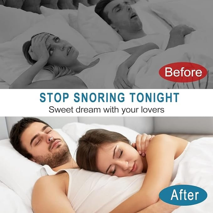 BUY 1 GET 1 FREE Anti Snore Devices, Silicone Magnetic Snore Stopper