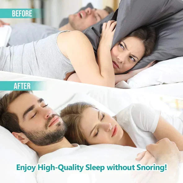 BUY 1 GET 1 FREE Anti Snore Devices, Silicone Magnetic Snore Stopper