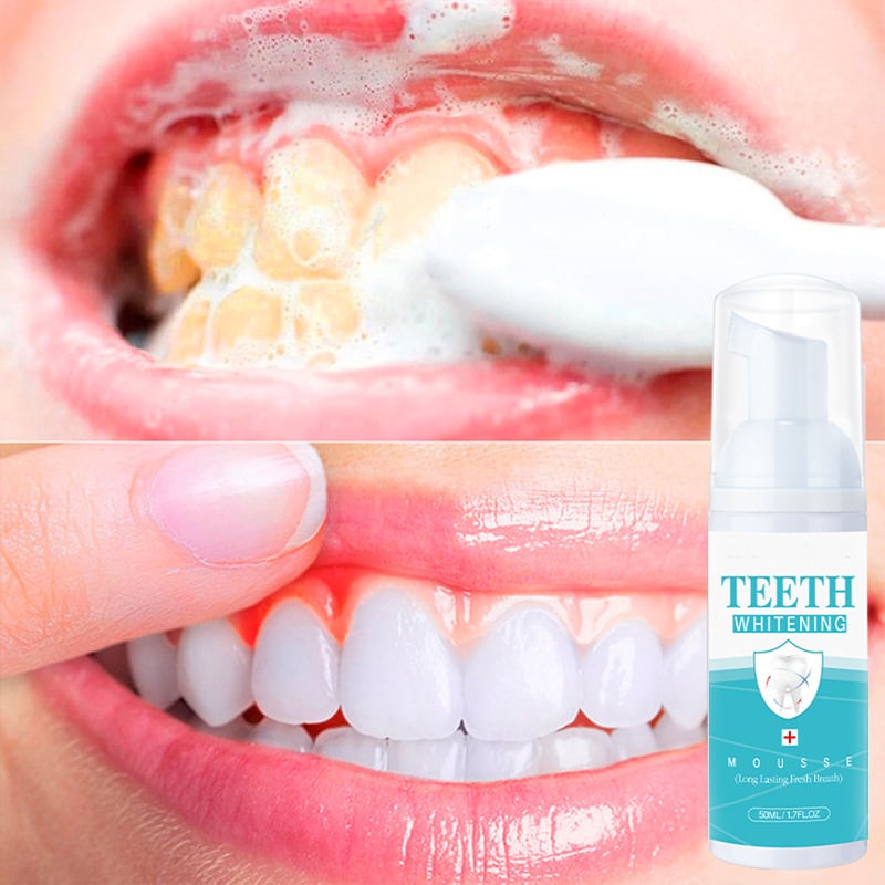 TEETH WHITENING MOUSSE